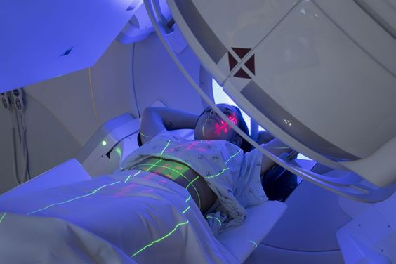 Cancer Radiation Treatment Explained